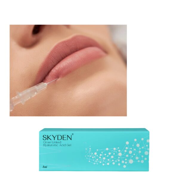 skyden dermal filler for face filling