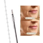 skyden pcl fishbone cog thread