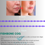 skyden pdo fishbone length of threads