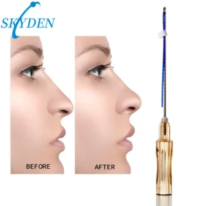 skyden pdo nose threads using after