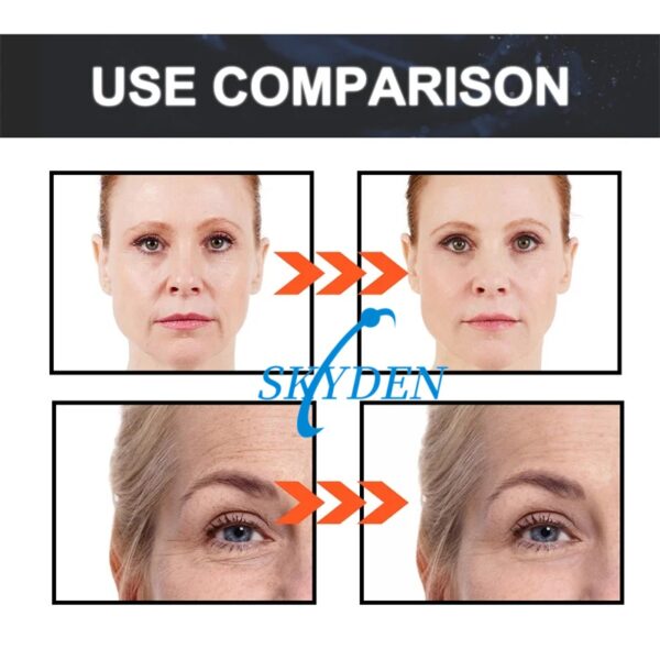 skyden plla filler comparison