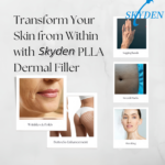 skyden plla filler application