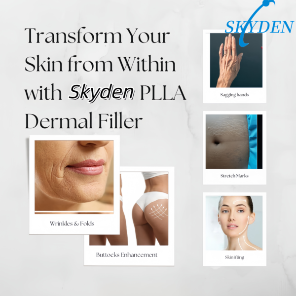 skyden plla filler application