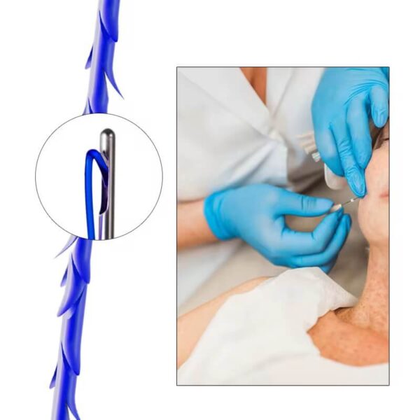 skyden pdo thread cog 12d face lifting