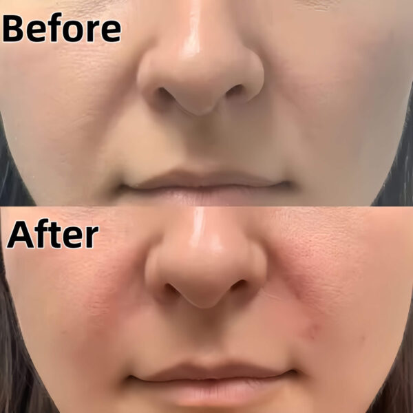 skyden pdo threads before and after