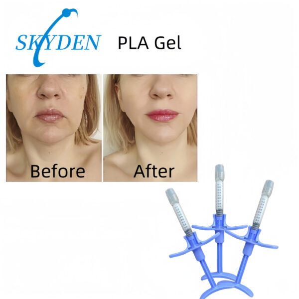 skyden pla gel before and after
