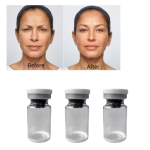 Botulinum toxin skyden manufacturer in china